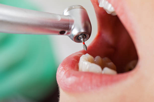 Best Orthodontic Emergency Dentist in Roscommon, MI